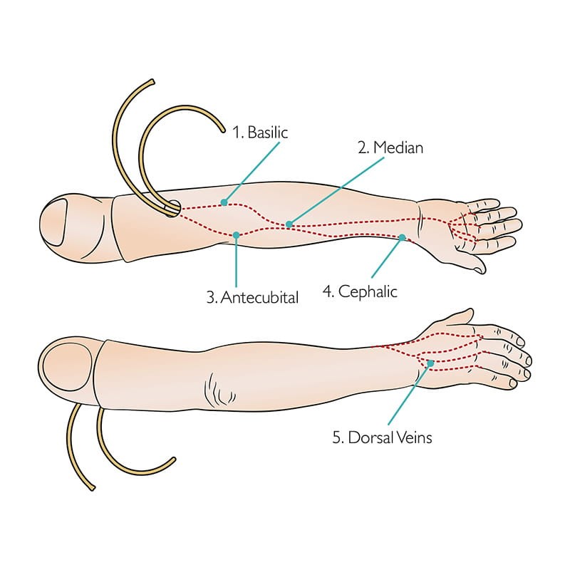 Set bras multiveines de formation à la perfusion intraveineuse, homme adulte