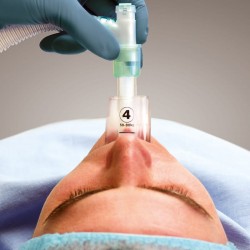 Supraglottische Einweg-Atemhilfe i-gel®, Anwendungsbeispiel Intubation